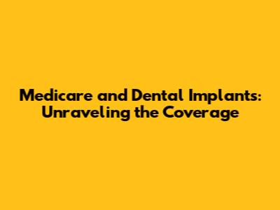 Medicare and Dental Implants: Unraveling the Coverage
